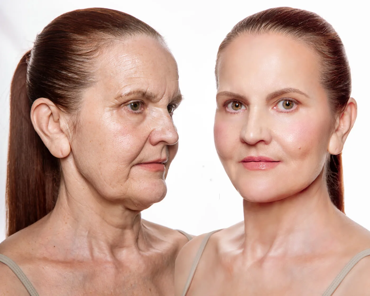 Before and after example