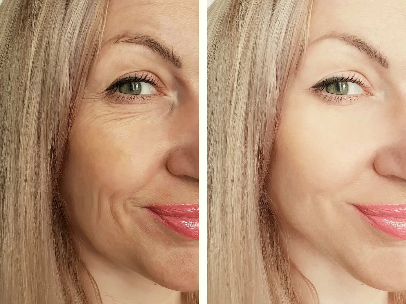 Before and after example