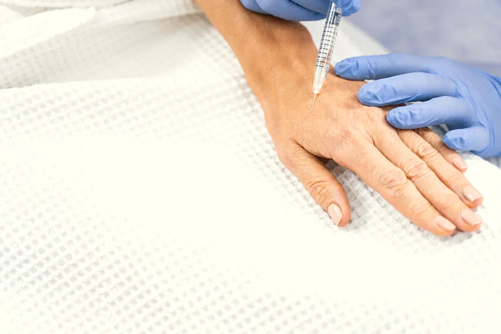 How long does Sculptra last, and what affects it